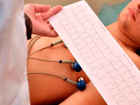 Eletrocardiograma (ECG) - Exame Cardiológico Rápido